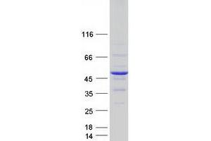 Validation with Western Blot