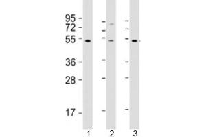 Western blot testing of human 1) HT-1080, 2) SH-SY5Y and 3) Y79 cell lysate with ZNF513 antibody at 1:2000. (ZNF513 抗体  (AA 82-115))