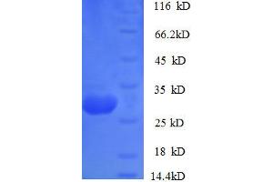 SDS-PAGE (SDS) image for Cathepsin K (CTSK) (AA 115-329) protein (His tag) (ABIN1473237)