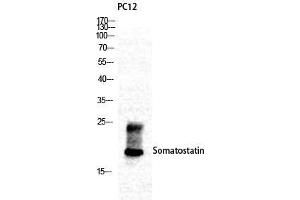 Western Blot (WB) analysis of specific cells using Somatostatin Polyclonal Antibody. (Somatostatin 抗体  (N-Term))