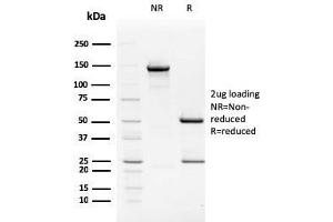 SDS-PAGE Analysis Purified TIM3 Mouse Monoclonal Antibody (TIM3/2399). (TIM3 抗体  (AA 22-202))
