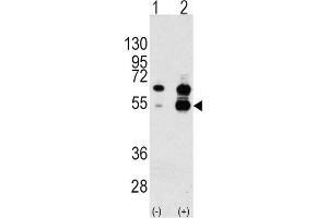 Western Blotting (WB) image for anti-PDGF and VEGF-Related Factor 1 (PVF1) antibody (ABIN3002600) (VEGF1 抗体)