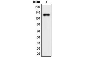 Western blot analysis of NEMF expression in Jurkat (A) whole cell lysates.