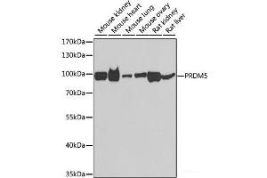 Western blot analysis of extracts of various cell lines using PRDM5 Polyclonal Antibody at dilution of 1:1000. (PRDM5 抗体)