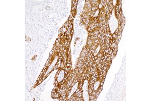 Immunohistochemistry (IHC) image for anti-Keratin 20 (KRT20) (AA 250-300) antibody (ABIN7453968) (Recombinant KRT20 抗体  (AA 250-300))