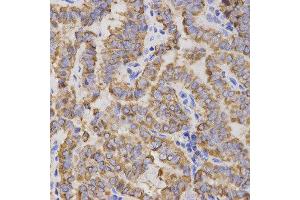 Immunohistochemistry (IHC) image for anti-Glycoprotein IX (Platelet) (GP9) antibody (ABIN1876562) (CD42a 抗体)