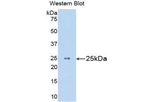 Western blot analysis of the recombinant protein. (Mannose Associated Serine Protease 2 (AA 22-142) 抗体)