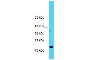 Host: Rabbit Target Name: GAGE12I Sample Type: PANC1 Whole Cell lysates Antibody Dilution: 1. (G Antigen 12I 抗体  (C-Term))