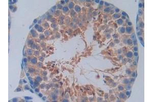 Detection of CCND2 in Mouse Testis Tissue using Polyclonal Antibody to Cyclin D2 (CCND2) (Cyclin D2 抗体  (AA 47-267))