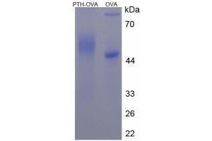 Image no. 2 for Parathyroid Hormone (PTH) peptide (Ovalbumin) (ABIN5666322) (Parathyroid Hormone (PTH) peptide (Ovalbumin))