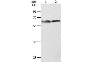Western Blot analysis of 293T and Jurkat cell using ALAS2 Polyclonal Antibody at dilution of 1:1000 (ALAS2 抗体)