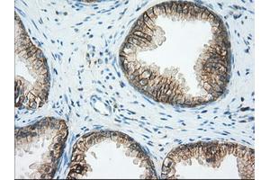Immunohistochemical staining of paraffin-embedded Human liver tissue using anti-BSG mouse monoclonal antibody. (CD147 抗体)