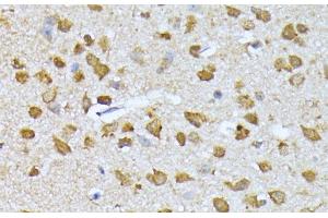 Immunohistochemistry (Paraffin-embedded Sections) (IHC (p)) image for anti-Ribosomal Protein S27a (RPS27A) antibody (ABIN7260073)