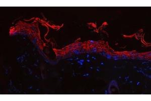 IF analysis of Cytokeratin 1/Krt1 using anti-Cytokeratin 1/Krt1 antibody (ABIN7600713). (Cytokeratin 1 抗体  (AA 223-439))