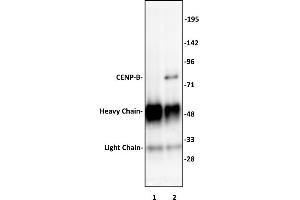 CENP-B antibody (pAb) tested by Immunoprecipitation. (CENPB 抗体  (C-Term))