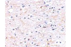 Immunohistochemical staining of human brain tissue using FNBP1L polyclonal antibody  at 2. (FNBP1L 抗体  (N-Term))
