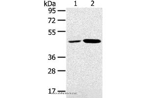 Western blot analysis of K562 and Jurkat cell, using SNX5 Polyclonal Antibody at dilution of 1:250 (SNX5 抗体)