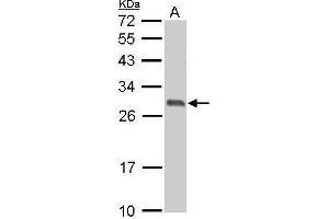 WB Image 14-3-3 sigma antibody detects SFN protein by Western blot analysis. (14-3-3 sigma/SFN 抗体  (C-Term))