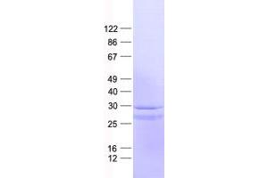 Validation with Western Blot (SH3BGR Protein (His tag))