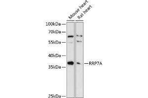 Western blot analysis of extracts of various cell lines, using RRP7A antibody (ABIN6133010, ABIN6147275, ABIN6147276 and ABIN6225048) at 1:3000 dilution. (RRP7A 抗体  (AA 1-280))