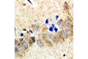 Immunohistochemical analysis of Carboxypeptidase A6 staining in rat brain  formalin fixed paraffin embedded tissue section. (CPA6 抗体)