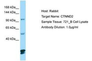 Image no. 1 for anti-Catenin (Cadherin-Associated Protein), delta 2 (Neural Plakophilin-Related Arm-Repeat Protein (CTNND2) (AA 1066-1115) antibody (ABIN6749992) (CTNND2 抗体  (AA 1066-1115))