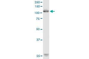 ROR1 monoclonal antibody (M02), clone 1B4. (ROR1 抗体  (AA 294-393))