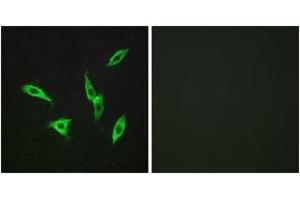 Immunofluorescence analysis of LOVO cells, using ADORA2B Antibody.