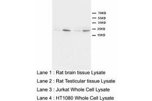 Image no. 1 for anti-High Mobility Group Box 4 (HMGB4) (N-Term) antibody (ABIN1495045) (HMGB4 抗体  (N-Term))