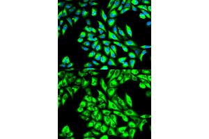 Immunofluorescence analysis of HeLa cells using EEF1A1 antibody. (eEF1A1 抗体)