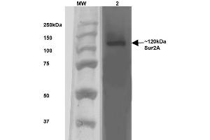 Western Blot analysis of Rat Brain Membrane showing detection of ~120 kDa SUR2A protein using Mouse Anti-SUR2A Monoclonal Antibody, Clone S319A-14 . (ABCC9 抗体  (AA 1505-1546) (HRP))