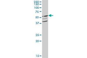 GCK MaxPab polyclonal antibody. (GCK 抗体  (AA 1-465))