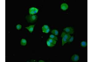 Immunofluorescent analysis of MCF-7 cells using ABIN7171717 at dilution of 1:100 and Alexa Fluor 488-congugated AffiniPure Goat Anti-Rabbit IgG(H+L) (SMG6 抗体  (AA 251-511))