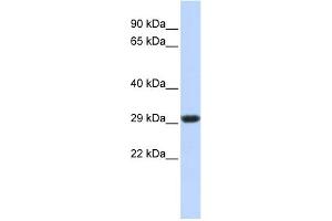 Western Blotting (WB) image for anti-Succinate Dehydrogenase Complex, Subunit B, Iron Sulfur (Ip) (SDHB) (Middle Region) antibody (ABIN2783181)