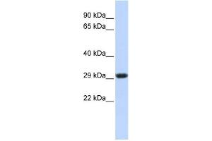 WB Suggested Anti-SDHB Antibody Titration:  0. (SDHB 抗体  (Middle Region))
