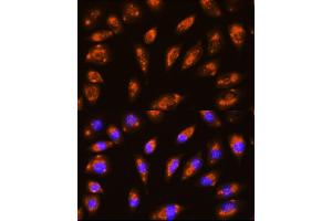 Immunofluorescence analysis of L929 cells using GRID1 Rabbit pAb (ABIN6129019, ABIN6141391, ABIN6141393 and ABIN6224034) at dilution of 1:100 (40x lens). (GRID1 抗体  (AA 880-1009))