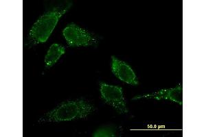 Immunofluorescence of monoclonal antibody to CBR3 on HeLa cell. (CBR3 抗体  (AA 180-277))
