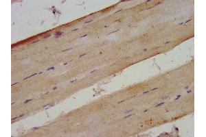 IHC image of ABIN7175925 diluted at 1:300 and staining in paraffin-embedded human skeletal muscle tissue performed on a Leica BondTM system. (XIRP2 抗体  (AA 2861-3004))