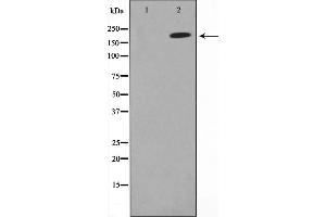 Western blot analysis on A549 cell lysate using MAGI2 Antibody,The lane on the left is treated with the antigen-specific peptide. (MAGI2 抗体  (N-Term))