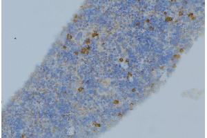 Immunohistochemistry (IHC) image for anti-serpin Peptidase Inhibitor, Clade A (Alpha-1 Antiproteinase, Antitrypsin), Member 1 (SERPINA1) (N-Term) antibody (ABIN6265001)