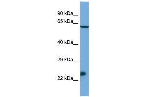 Host:  Rabbit  Target Name:  Msx3  Sample Type:  SP2/0 Whole Cell lysates  Antibody Dilution:  1.