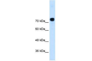 WB Suggested Anti-ACTN4  Antibody Titration: 0. (alpha Actinin 4 抗体  (N-Term))