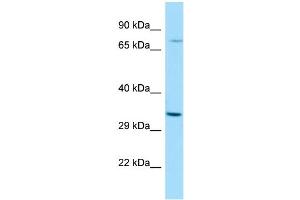 WB Suggested Anti-RASL11A Antibody Titration: 1. (RASL11A 抗体  (N-Term))