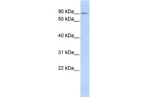 WB Suggested Anti-NCAPH Antibody Titration:  0. (NCAPH 抗体  (N-Term))