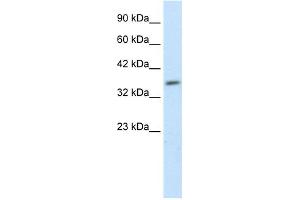 WB Suggested Anti-HEYL Antibody Titration: 1. (HEYL 抗体  (N-Term))