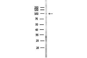 Western blot analysis of lysates from Hela cells(LPS 4h treatment), using MASTL Antibody at 1/1000 dilution.