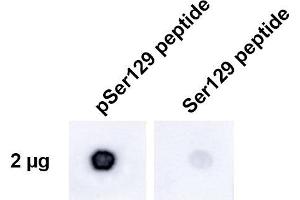 Dot Blot analysis using Rabbit Anti-Alpha Synuclein pSer129 Monoclonal Antibody, Clone J18 (ABIN6932878). (SNCA 抗体  (pSer129) (FITC))