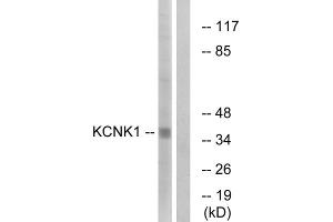 Western blot analysis of extracts from Jurkat cells, using KCNK1 antibody. (KCNK1 抗体  (C-Term))