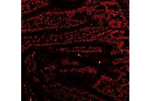 anti-C-terminal Binding Protein 2 (CTBP2) (AA 321-445) antibody