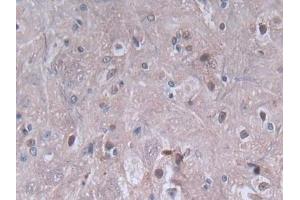 IHC-P analysis of Rat Spinal cord Tissue, with DAB staining. (PF4 抗体  (AA 30-105))